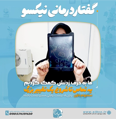 گفتاردرمانی سندروم داون