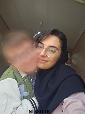 گفتاردرمانی ارومیه - سندروم داون